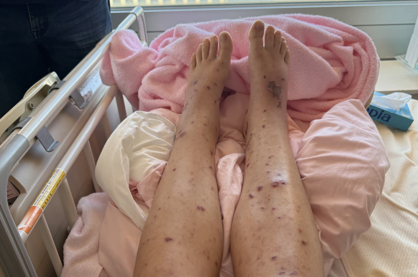 Anna Gallo illness symptoms